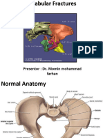 Acetabular Fractures