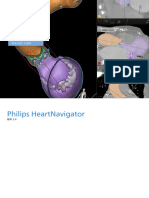 Philips HeartNavigator