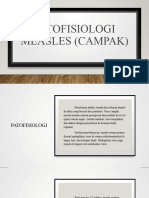 Patofisiologi Measles (Campak)