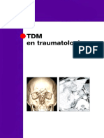 TDM en Traumatologie (Imagerie Médicale Diagnostic) (French Edition) (Ingrid Millet-Cénac, Patrice Taourel)