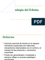 Edema