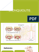 Bronquiolitis