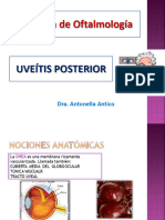 Uveítis Posterior 2021