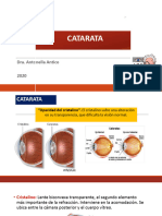 Catarata Oftalmología. Corregido-1
