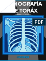 Manual RX de Torax