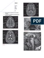 Chapter 2 Introduction To Brain Imaging