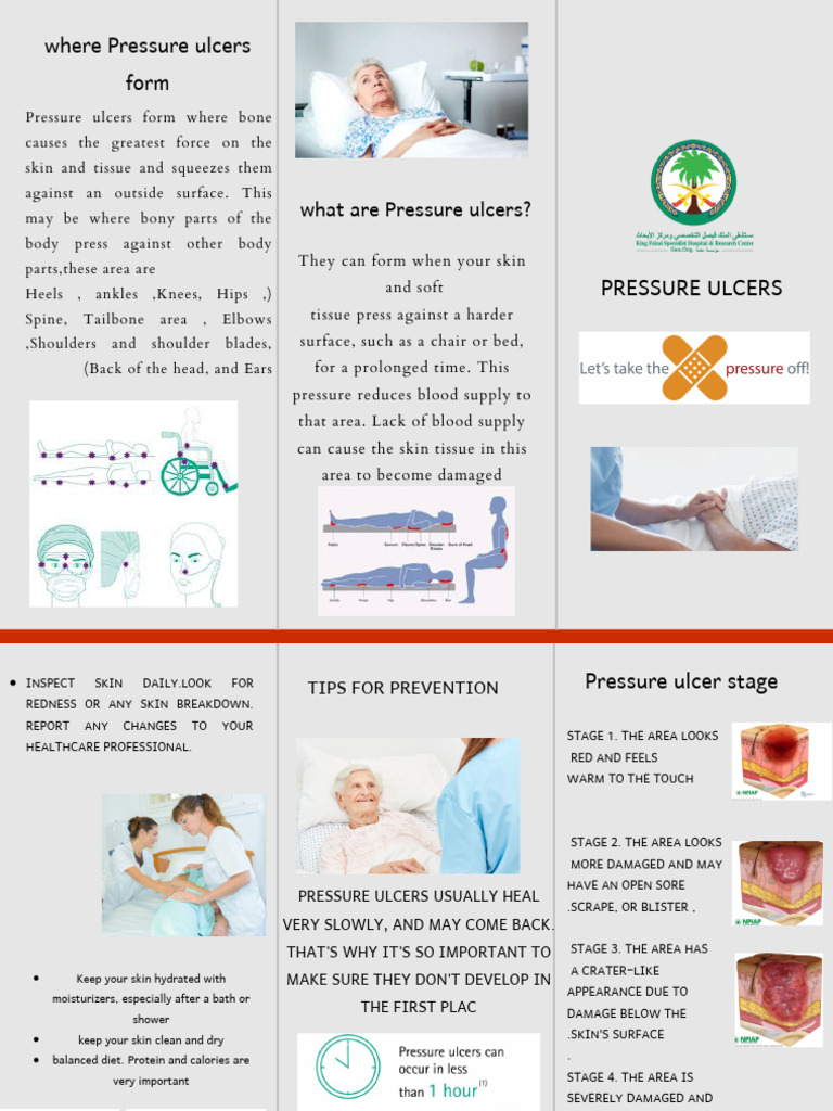Pressure Ulcer | PDF | Clinical Medicine | Medical Specialties