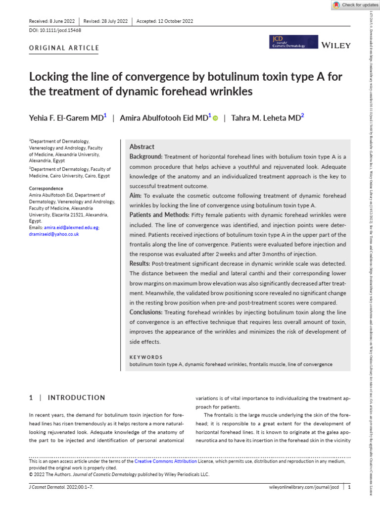 Locking The Line of Convergence by Botulinum Toxin Type A For The ...