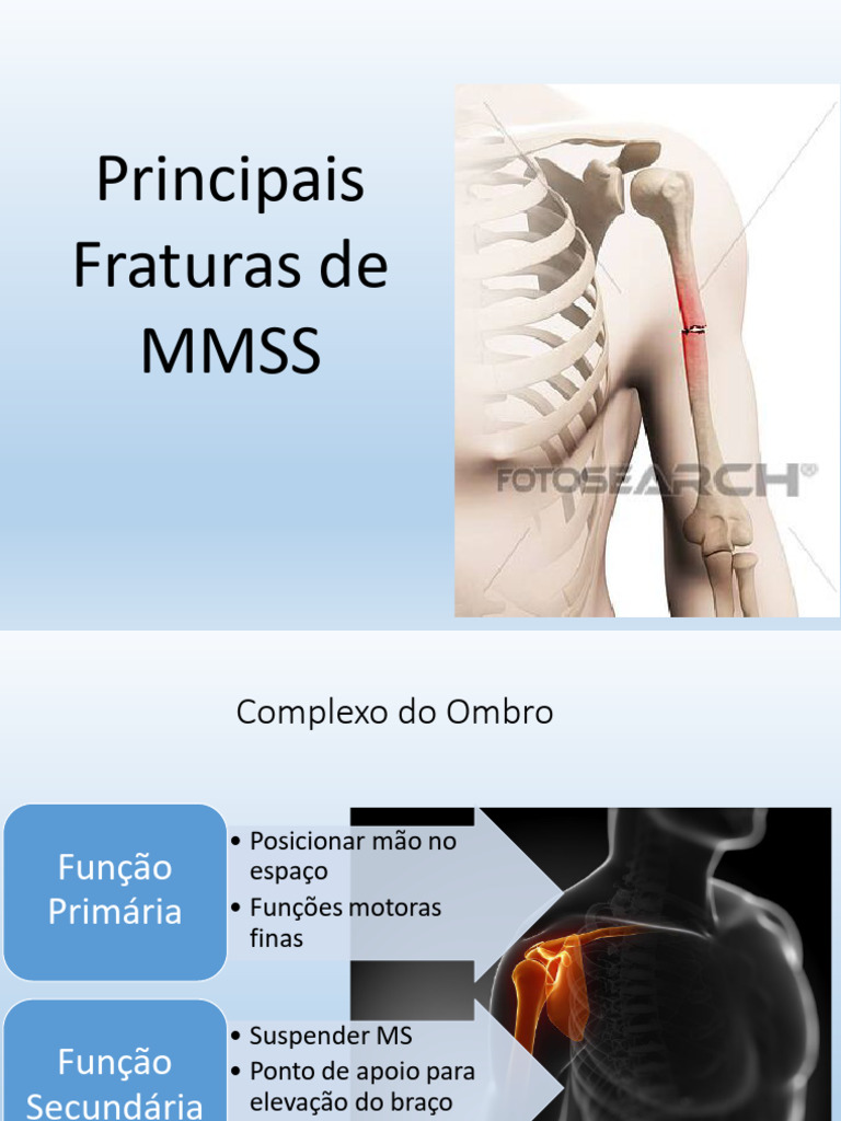 Fraturas do Complexo do Ombro: Tipos e Tratamento | PDF | Bem-estar ...