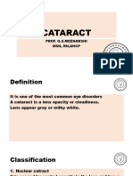 Cataract