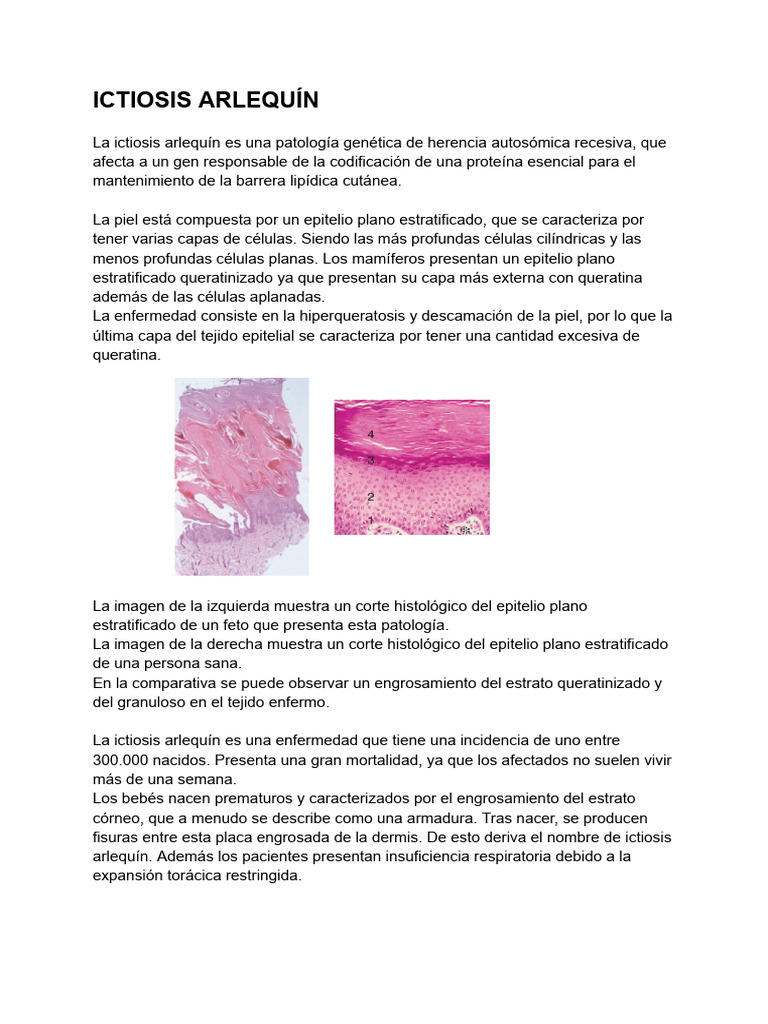 Ictiosis Arlequín PDF