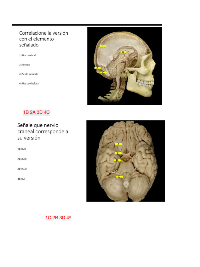 Anatomía de la Tórcula Cerebro | PDF | Anatomía humana | Extremidades ...
