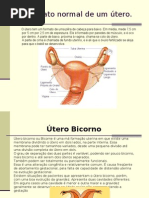 Útero Bicorno.