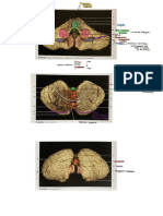 Cerebelo Prácticas