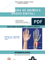 Fractura de Muñeca