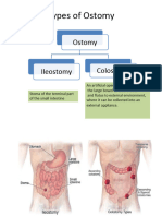 Ostomy