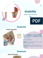 Uretritis