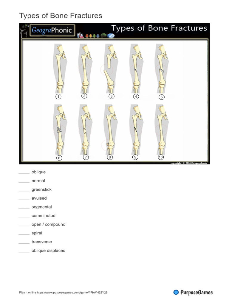 Fracture Worksheet PDF