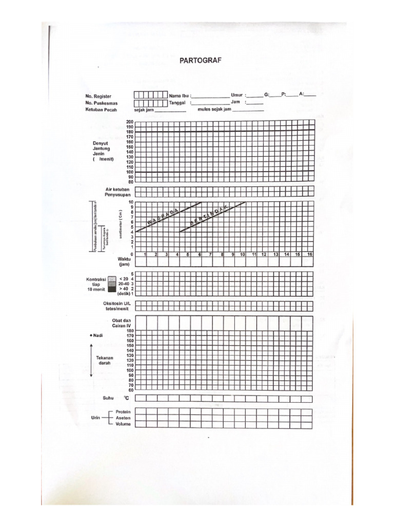 PARTOGRAF | PDF