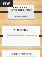 ABCDE Approach to Chest X-Ray Interpretation | PDF | Lung | Thorax