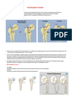 Femoral 