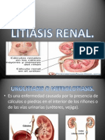 Sis y Litiasis Renal.