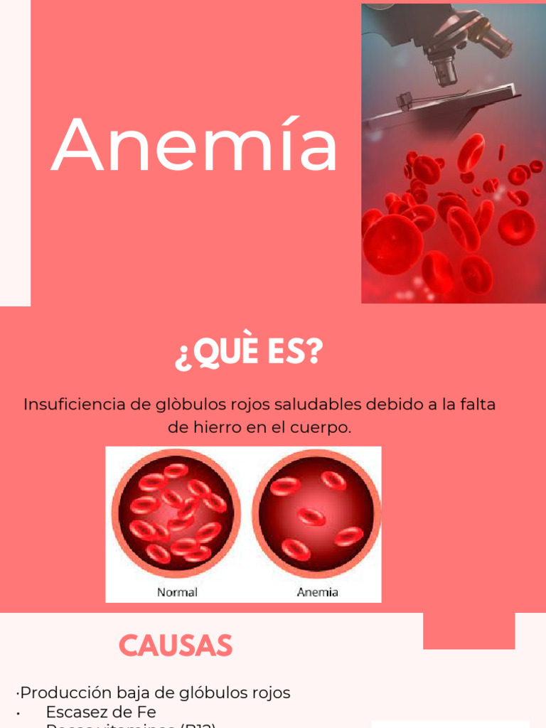 Tipos y causas de anemia | PDF | Sangre | Glóbulo rojo