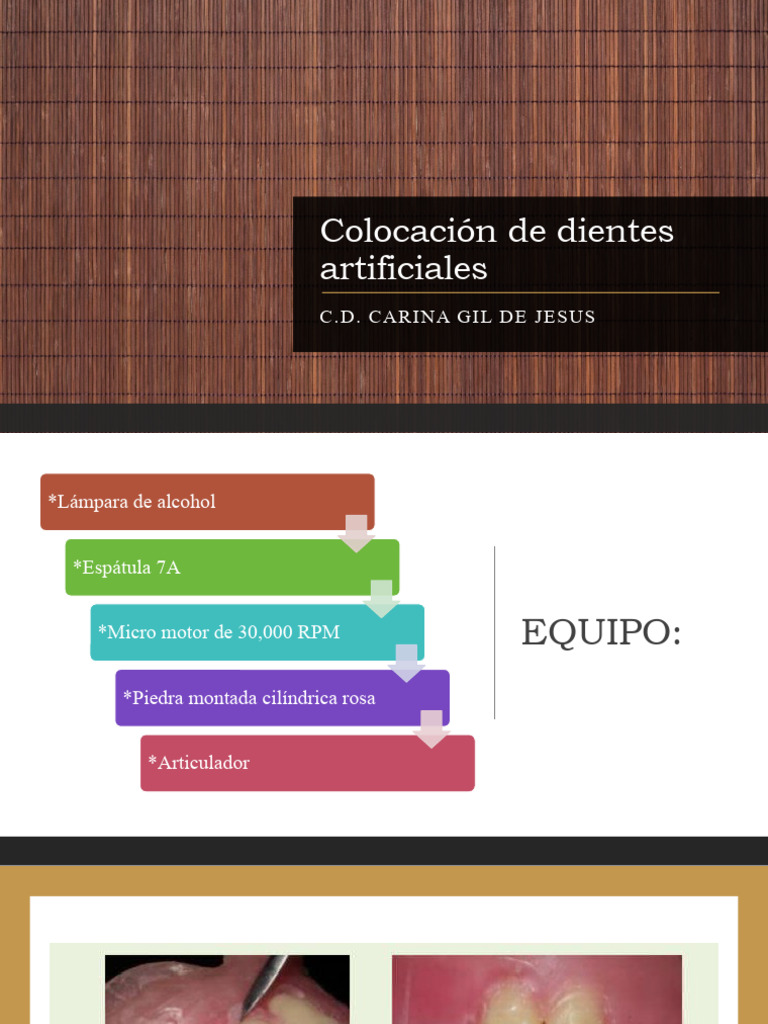Enfilado y Contacto Oclusal de Dientes | PDF | Odontología | Ramas de ...