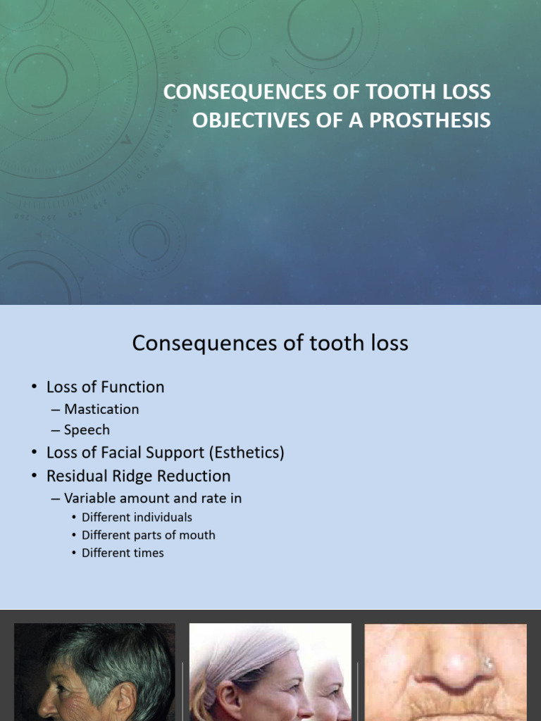 Objectives of A Prosthesis Handouts PDF Dentures Human Anatomy