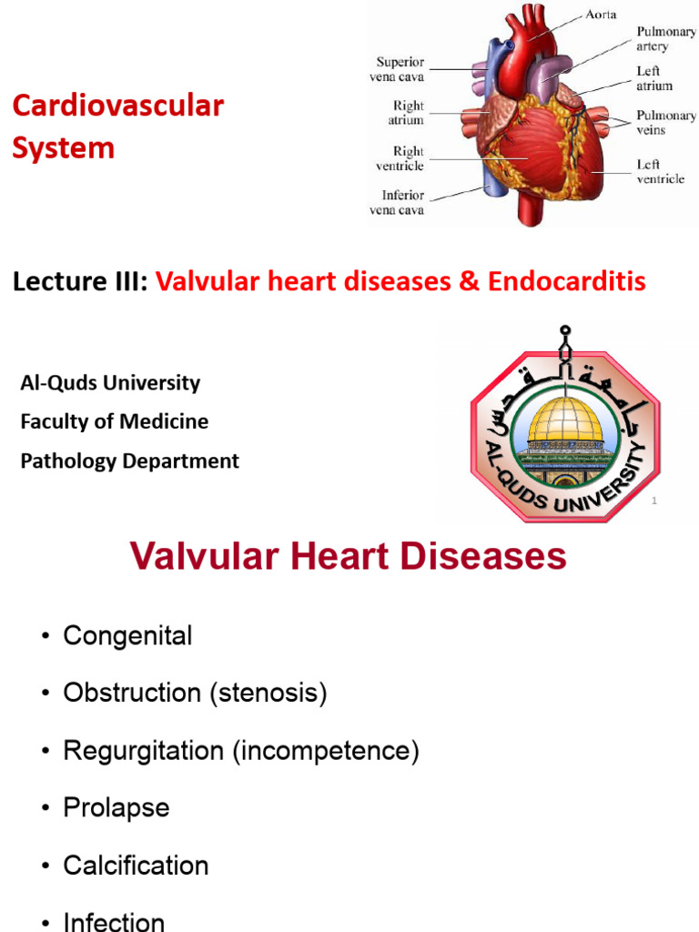 Lecture III Valvular Heart Diseases and Endocarditis PDF Heart Valve Heart