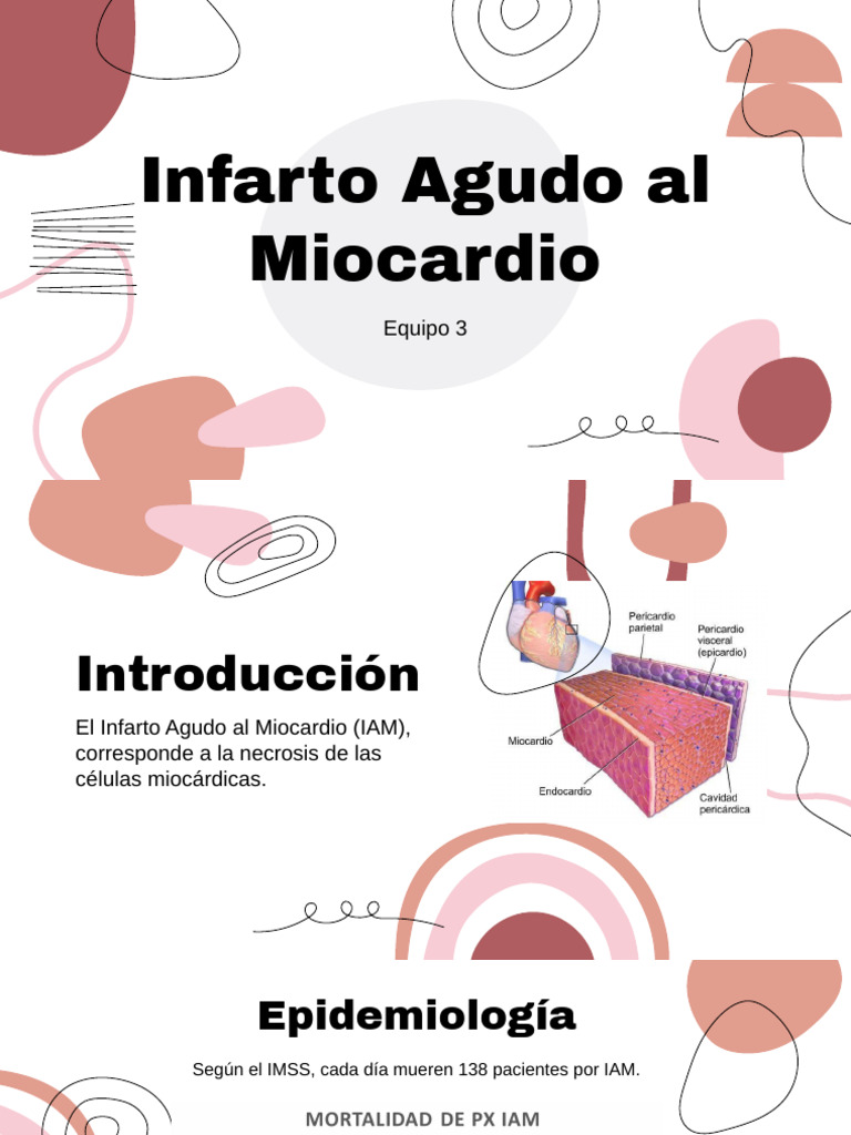 Nfarto Agudo de Miocardio | Descargar gratis PDF | Infarto de miocardio ...
