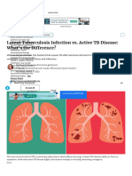 Latent Tuberculosis Infection vs. Active TB Disea