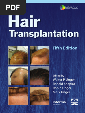Hair Transplantation-Informa Healthcare 5th Ed. (2011) | PDF