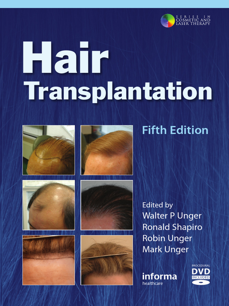 Hair Transplantation Fifth Edition（洋書） Hair Transplantation Fifth Edition（洋書） Buy Hair