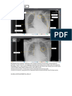 Catatan Radiologi