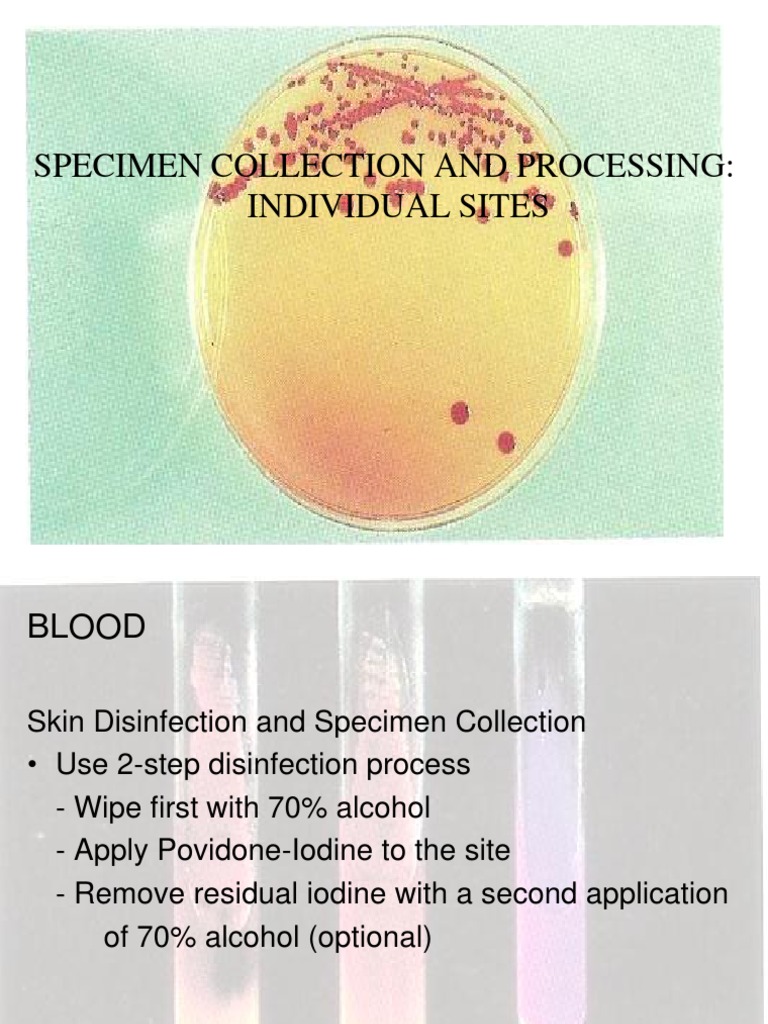 Specimen Collection, Transport and Processing PDF Meningitis