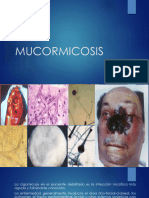 Clase 16 Mucormicosis y Queratitis Micotica