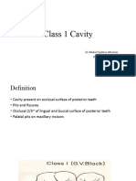 Class 1 Cavity-1