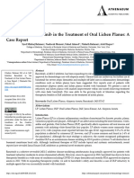 JAK Inhibitor Baricitinib in The Treatment of Oral Lichen Planus A Case Report