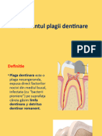 Tratamentul Plagii Dentinare