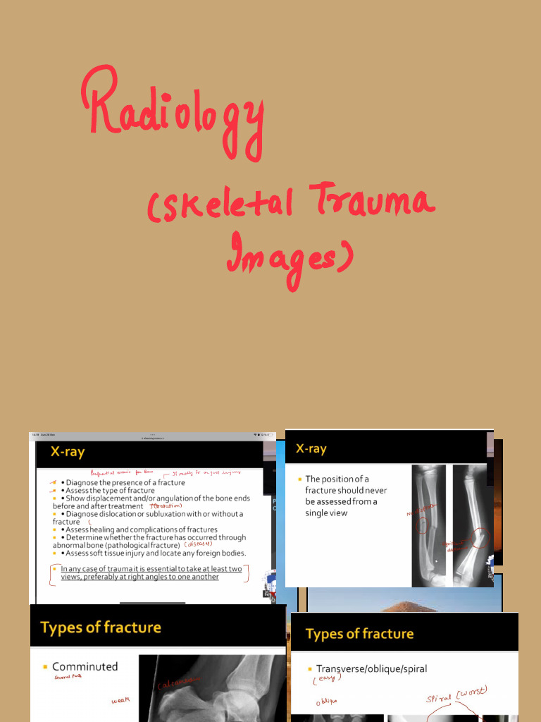 Radiology Skeletal Trauma by Pasinkov | PDF