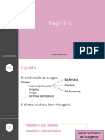 Vaginitis