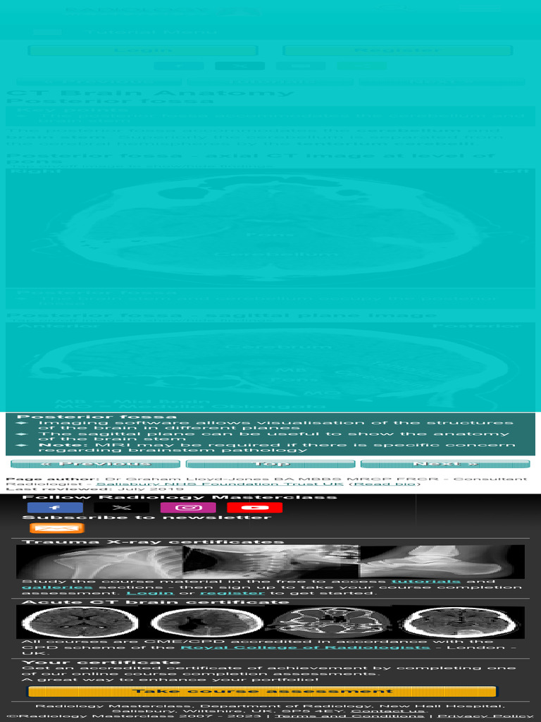 CT Brain Posterior Fossa Anatomy | PDF | Science \u0026 Mathematics | Computers, image size:768x1024