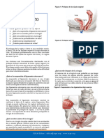 Uterosacral Ligament Suspension Spanish