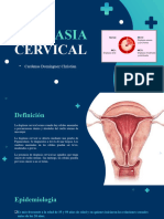 Displasia Cervical