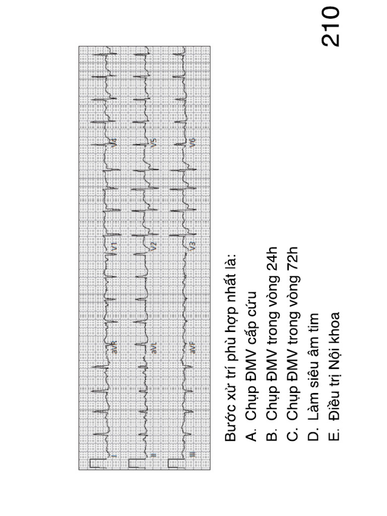 Ecg 3 | PDF