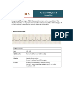 eCG Rhythms