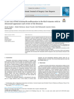 A Rare Case of Fetal Sirenomelia Malformation in The - 2024 - International Jour