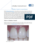 Difference Between Maxillary Central and Lateral Incisor
