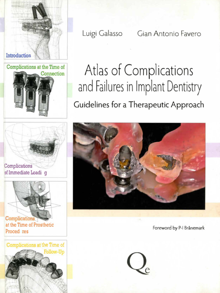 Atlas of Complications and Failures in Implant Dentistry | PDF | Dental ...